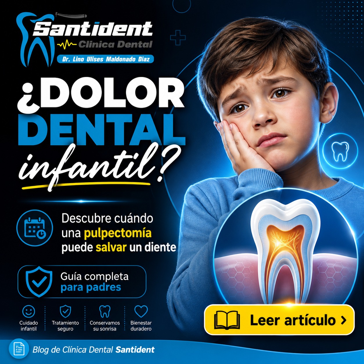 Pulpectomía dental: tratamiento para salvar un diente infantil con caries profunda